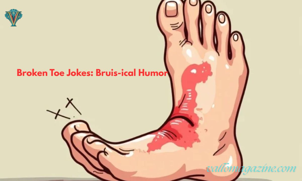 330+ Broken Toe Jokes: Bruis-ical Humor to Lighten the Ouch