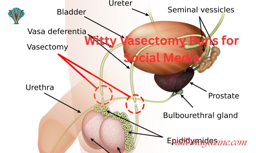 Witty Vasectomy Puns for Social Media